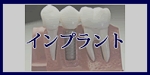 インプラントへのメニューボタン
